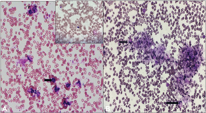 Use of Nitroblue Tetrazolium Test: Revisited in Context of COVID-19.