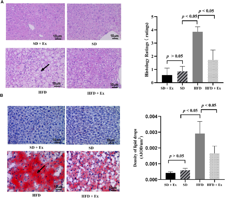 Effect of aerobic exercise on GRP78 and ATF6 expressions in mice with non-alcoholic fatty liver disease