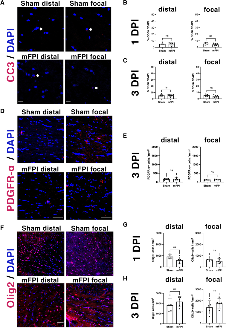 Mature and Myelinating Oligodendrocytes Are Specifically Vulnerable to Mild Fluid Percussion Injury in Mice.