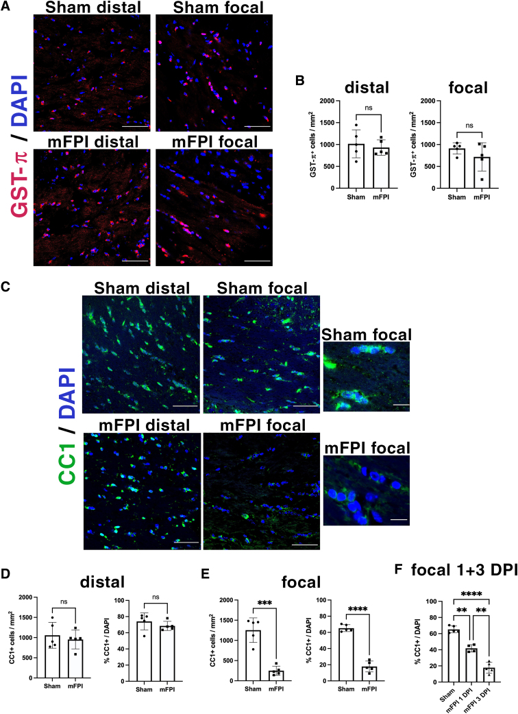 Mature and Myelinating Oligodendrocytes Are Specifically Vulnerable to Mild Fluid Percussion Injury in Mice.