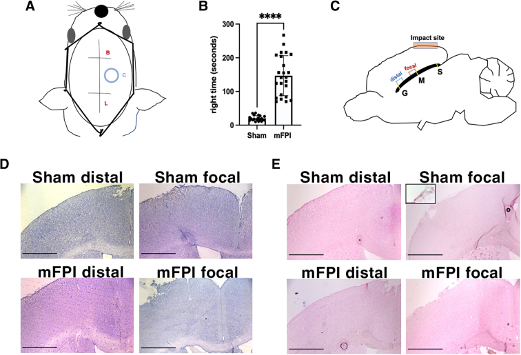 Mature and Myelinating Oligodendrocytes Are Specifically Vulnerable to Mild Fluid Percussion Injury in Mice.