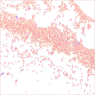 Prevalence of the <i>bla</i><sub>CTX-M</sub> and <i>bla</i><sub>TEM</sub> genes among extended-spectrum beta lactamase-producing <i>Escherichia coli</i> isolated from broiler chickens in Indonesia.