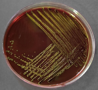 Prevalence of the <i>bla</i><sub>CTX-M</sub> and <i>bla</i><sub>TEM</sub> genes among extended-spectrum beta lactamase-producing <i>Escherichia coli</i> isolated from broiler chickens in Indonesia.