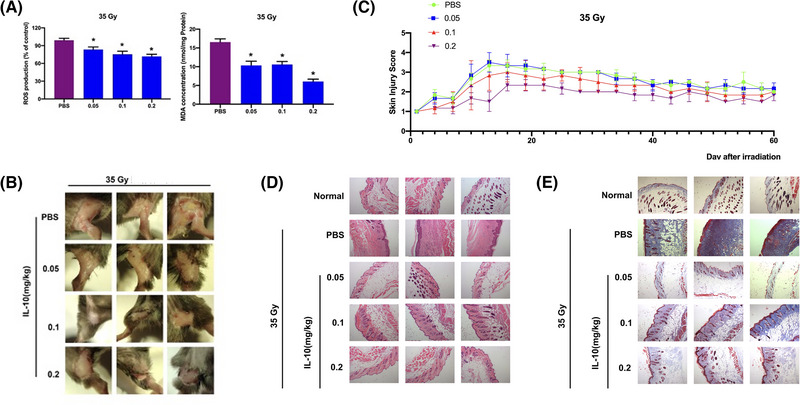 Erb-(IL10)2 ameliorates radiation-induced skin injury through eliminate oxygen free radicals.