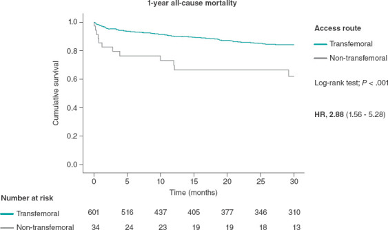 [Transcatheter aortic valve implantation via percutaneous alternative access routes: outcomes].