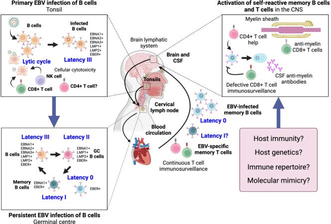 Epstein–Barr virus and multiple sclerosis: the dawn of a new age