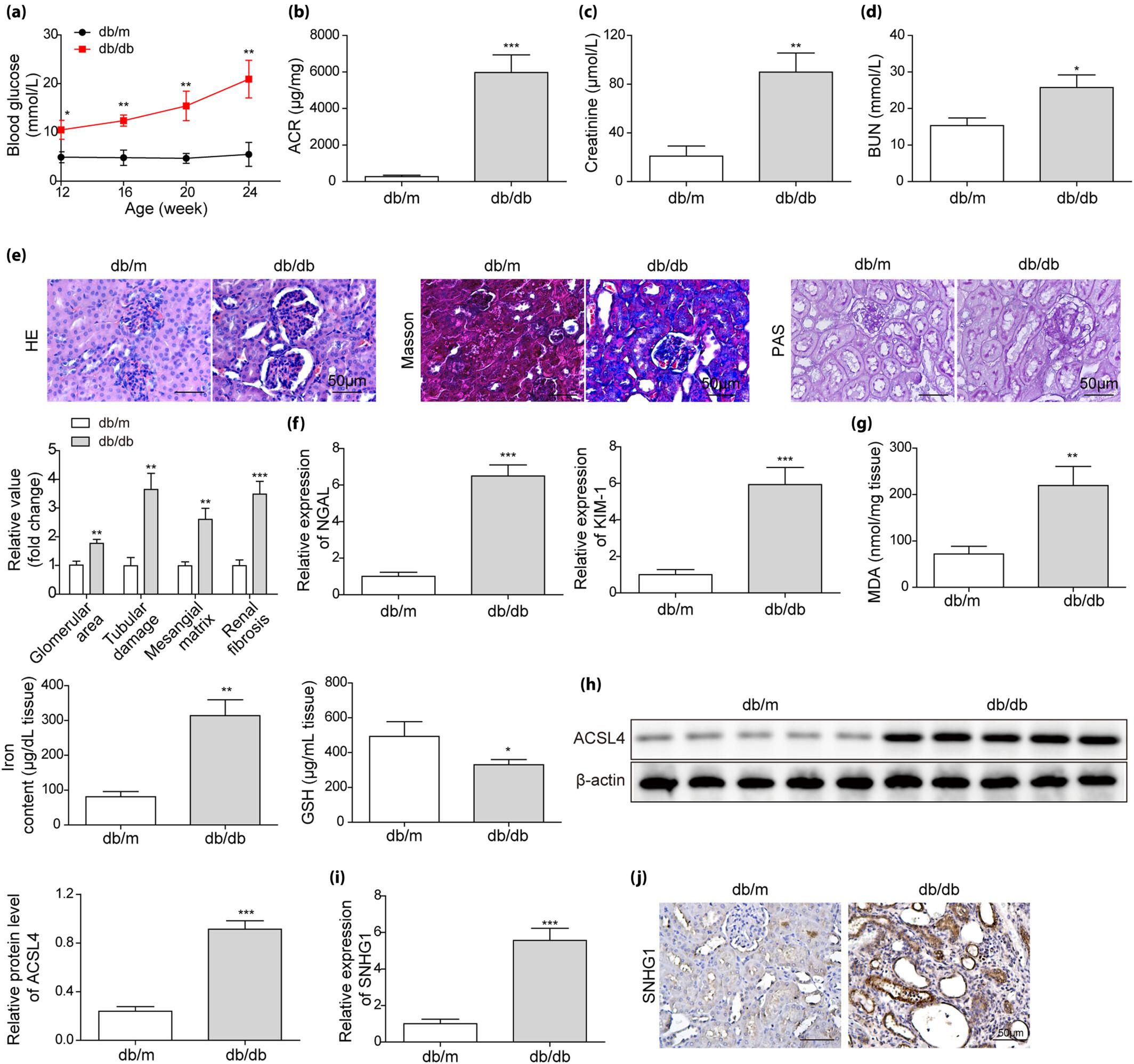 LncRNA SNHG1 knockdown inhibits hyperglycemia induced ferroptosis via miR-16-5p/ACSL4 axis to alleviate diabetic nephropathy