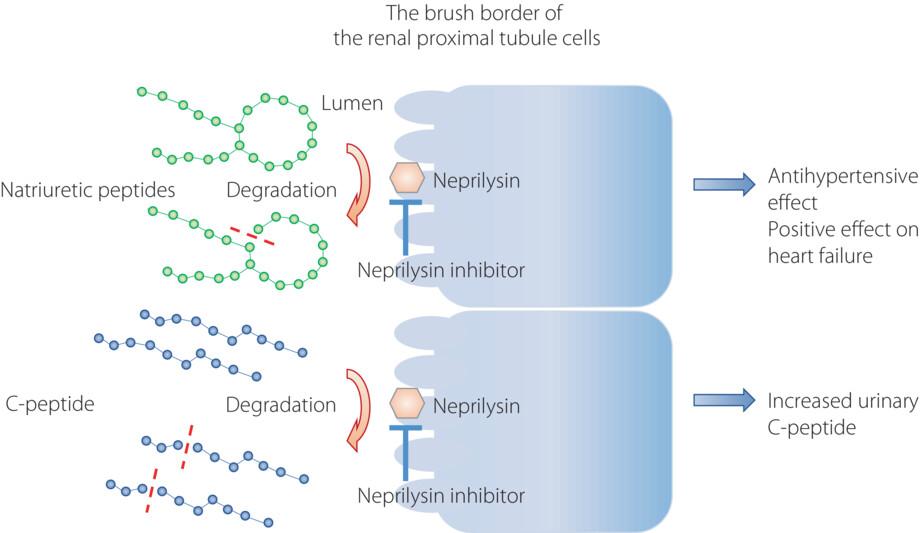 Impact of the angiotensin receptor-neprilysin inhibitor in clinical diabetes management: Potential benefits and pitfalls