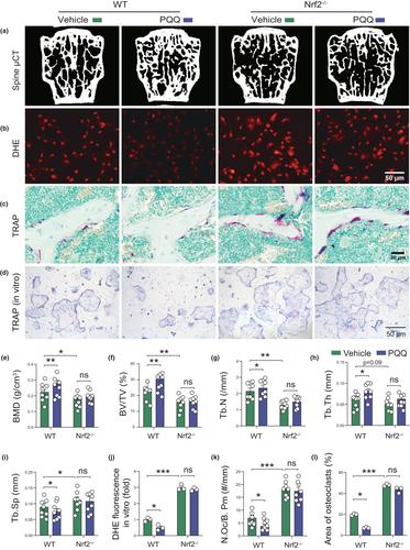 Pyrroloquinoline quinone alleviates natural aging-related osteoporosis via a novel MCM3-Keap1-Nrf2 axis-mediated stress response and Fbn1 upregulation