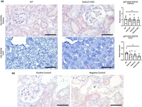 Deficiency for scavenger receptors Stabilin-1 and Stabilin-2 leads to age-dependent renal and hepatic depositions of fasciclin domain proteins TGFBI and Periostin in mice