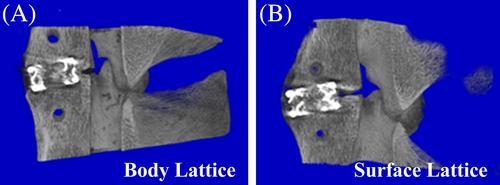 Novel 3D printed lattice structure titanium cages evaluated in an ovine model of interbody fusion