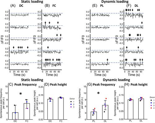 The influence of intervertebral disc overloading on nociceptor calcium flickering