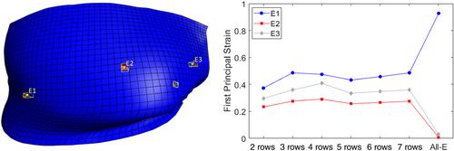 Cervical facet capsular ligament mechanics: Estimations based on subject-specific anatomy and kinematics