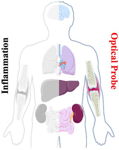 Fluorescence Imaging of Inflammation with Optical Probes