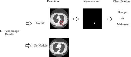 Applications of deep learning in disease diagnosis of chest radiographs: A survey on materials and methods