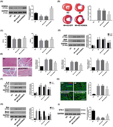 LncRNA H19 ameliorates myocardial infarction-induced myocardial injury and maladaptive cardiac remodelling by regulating KDM3A