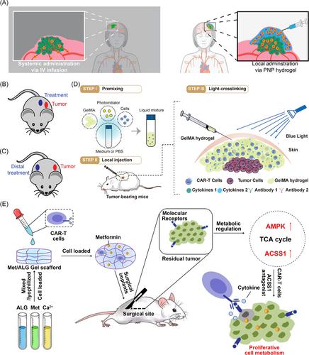 Delivering CAR-T cells into solid tumors via hydrogels