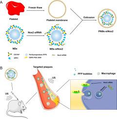 Ultrasound-assisted biomimetic nanobubbles for targeted treatment of atherosclerosis