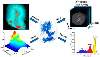 3D-imaging and quantitative assessment for size-related penetration of HfO2 nanoparticles in breast cancer tumor by synchrotron radiation microcomputed tomography