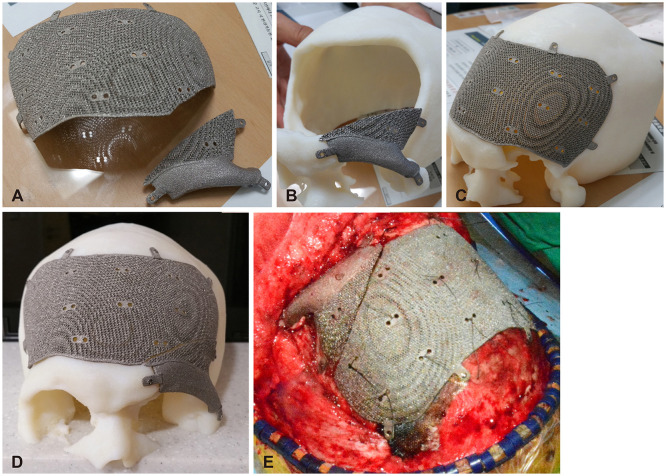 Medical Applications of 3D Printing and Standardization Issues.