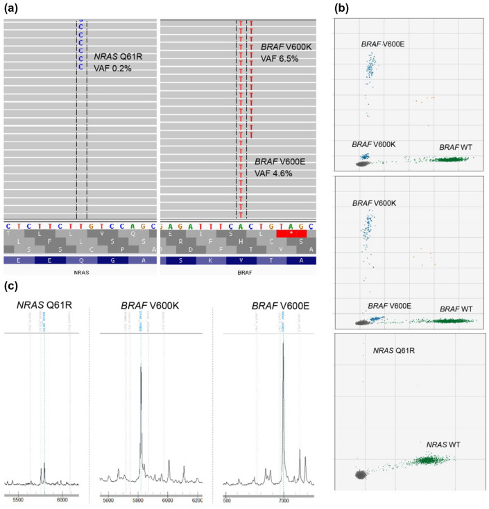 Dynamic ctDNA Mutational Complexity in Patients with Melanoma Receiving Immunotherapy.