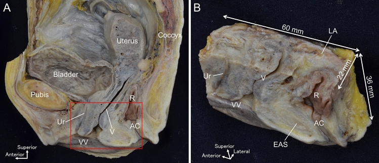 Novel combination method of wide-range serial sectioning and 3D reconstruction visualizing both macro-level dynamics and micro-level interactions in an attempt to analyze the female pelvic floor