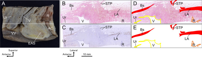 Novel combination method of wide-range serial sectioning and 3D reconstruction visualizing both macro-level dynamics and micro-level interactions in an attempt to analyze the female pelvic floor