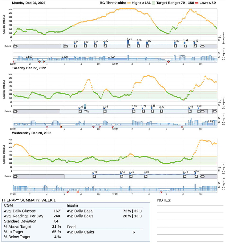 Diabetic Ketoacidosis in a Patient With Type I Diabetes Treated With a Closed-Loop Sensor–Augmented Insulin Infusion System