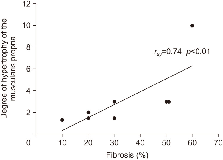 The Utility of Contrast Enhanced Ultrasound and Elastography in the Early Detection of Fibro-Stenotic Ileal Strictures in Children with Crohn's Disease.