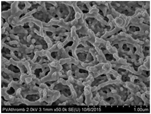 A retrospective, comparative, clinical study of occlusion rate of peripherally inserted central catheters fabricated of poly(vinyl alcohol)-based hydrogel composite