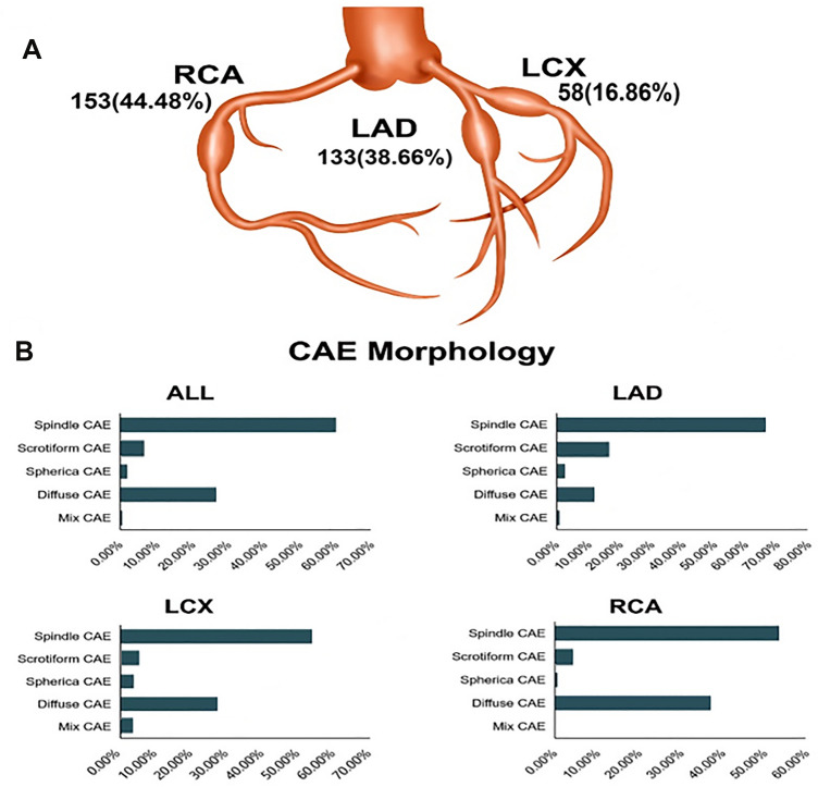 Characteristics of coronary artery ectasia and accompanying plaques: an optical coherence tomography study.