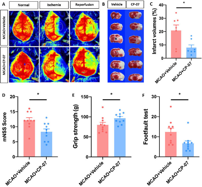 A newly-synthesized compound CP-07 alleviates microglia-mediated neuroinflammation and ischemic brain injury via inhibiting STAT3 phosphorylation.