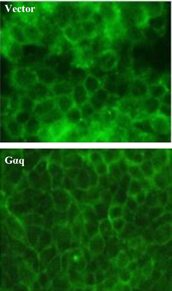 Gαq Signaling Activates β-Catenin-Dependent Gene Transcription