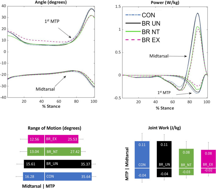 Kinetic coupling in distal foot joints during walking.