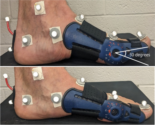 Kinetic coupling in distal foot joints during walking.