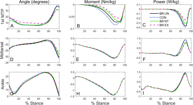 Kinetic coupling in distal foot joints during walking.