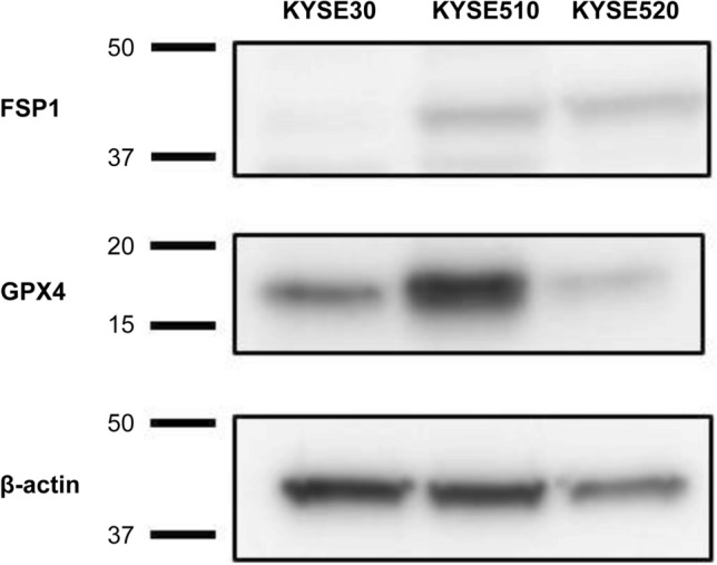 Simultaneous regulation of ferroptosis suppressor protein 1 and glutathione peroxidase 4 as a new therapeutic strategy of ferroptosis for esophageal squamous cell carcinoma.