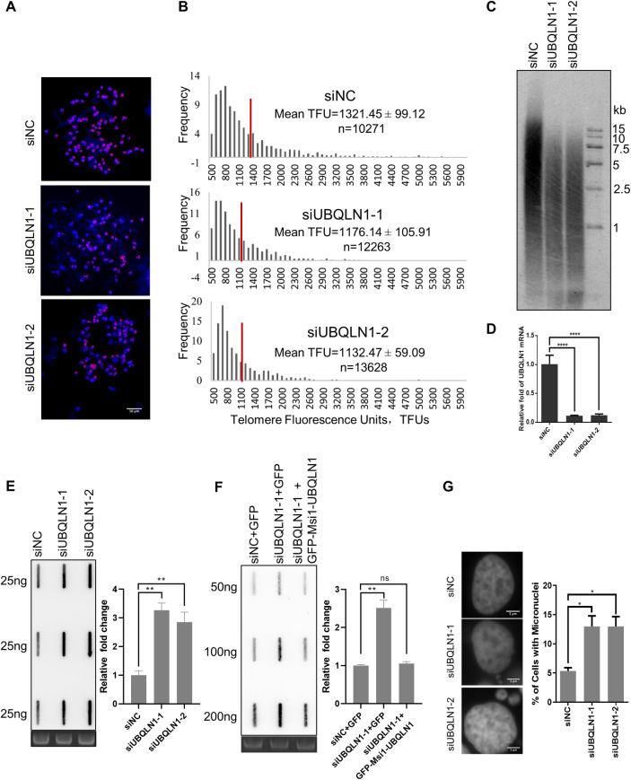 UBQLN1 deficiency mediates telomere shortening and IPF through interacting with RPA1.