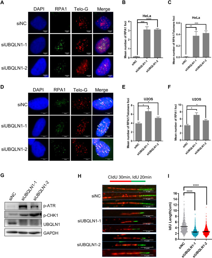 UBQLN1 deficiency mediates telomere shortening and IPF through interacting with RPA1.