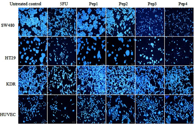 Designing Potent Anticancer Peptides by Aurein 1.2 Key Residues Mutation and Catenate Cell-Penetrating Peptide.