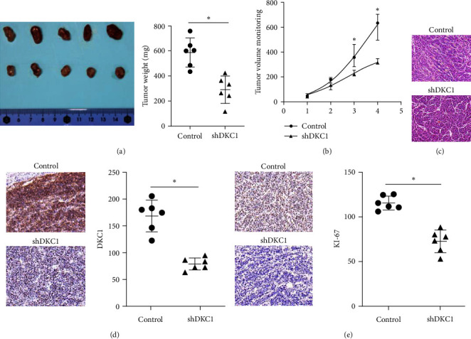 miRNA326-5p Targets DKC1 Gene to Regulate Apoptosis-Related Proteins and Intervene in the Development of Neuroblastoma.