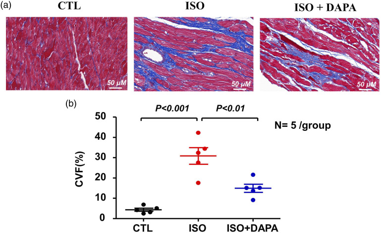 Dapagliflozin attenuates cardiac remodeling and dysfunction in rats with β-adrenergic receptor overactivation through restoring calcium handling and suppressing cardiomyocyte apoptosis.