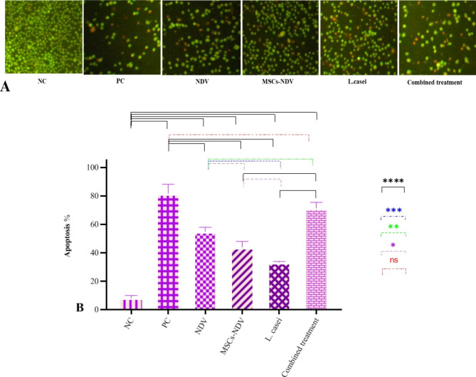 Antiproliferative effects of mesenchymal stem cells carrying Newcastle disease virus and Lactobacillus Casei extract on CT26 Cell line: synergistic effects in cancer therapy.