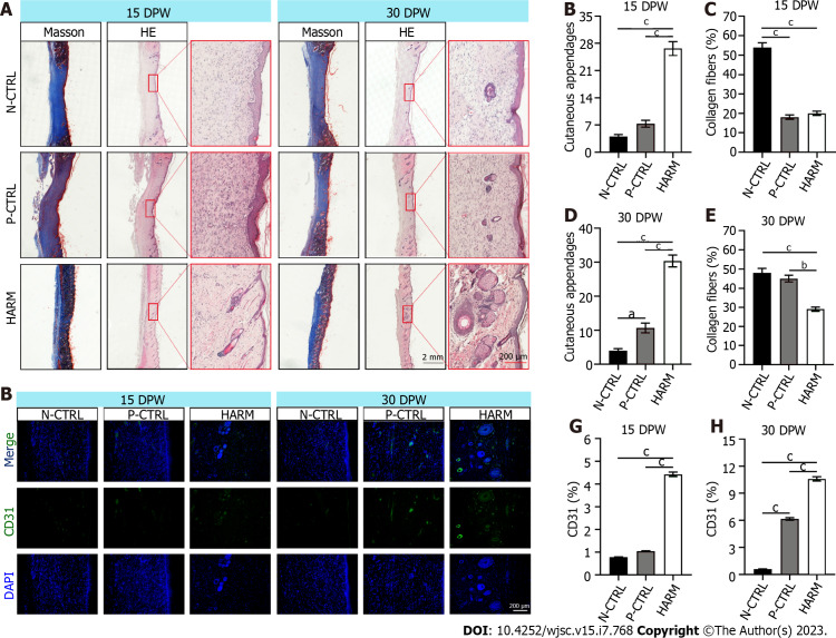 Injectable hydrogel made from antler mesenchyme matrix for regenerative wound healing <i>via</i> creating a fetal-like niche.