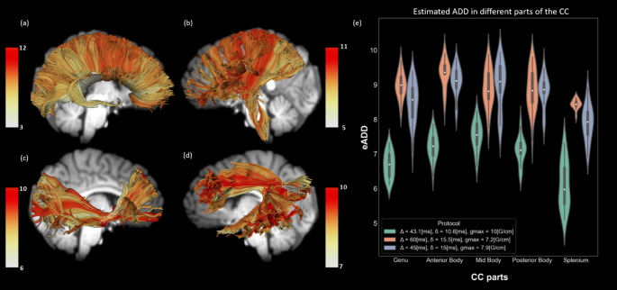 A Method for In-Vivo Mapping of Axonal Diameter Distributions in the Human Brain Using Diffusion-Based Axonal Spectrum Imaging (AxSI).