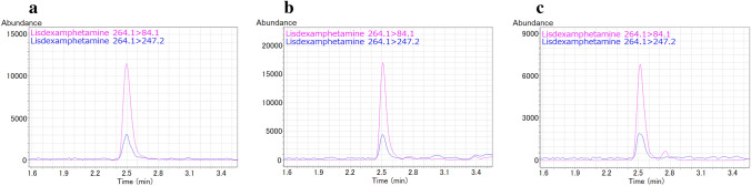 Detection of lisdexamfetamine and its metabolite d-amphetamine in urine and gastric contents collected from a cadaver at forensic autopsy.