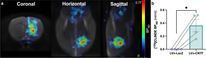 Reactive astrocytes mediate TSPO overexpression in response to sustained CNTF exposure in the rat striatum.