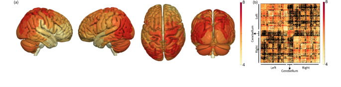 A Method for In-Vivo Mapping of Axonal Diameter Distributions in the Human Brain Using Diffusion-Based Axonal Spectrum Imaging (AxSI).