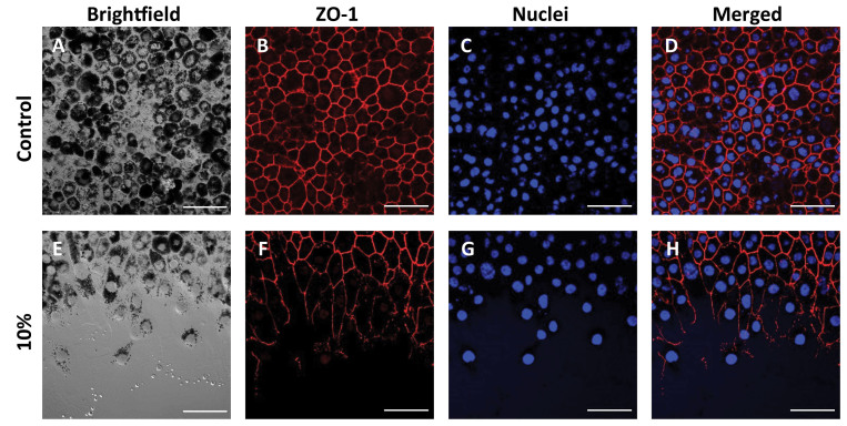 The impact of early RPE cell junction loss on VEGF, Ang-2, and TIMP secretion in vitro.