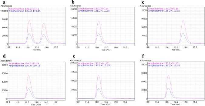 Detection of lisdexamfetamine and its metabolite d-amphetamine in urine and gastric contents collected from a cadaver at forensic autopsy.